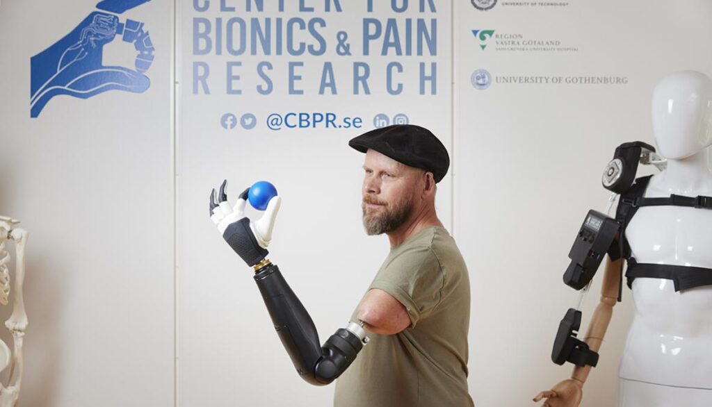 Controlling Every Finger of a Bionic Hand