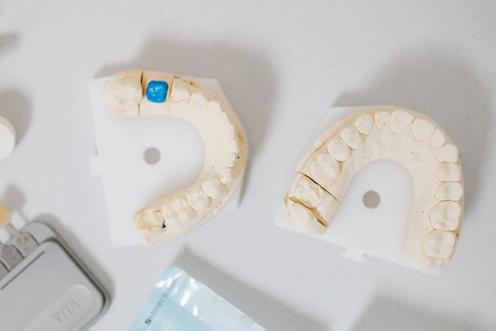 dental-teeth-cast-models